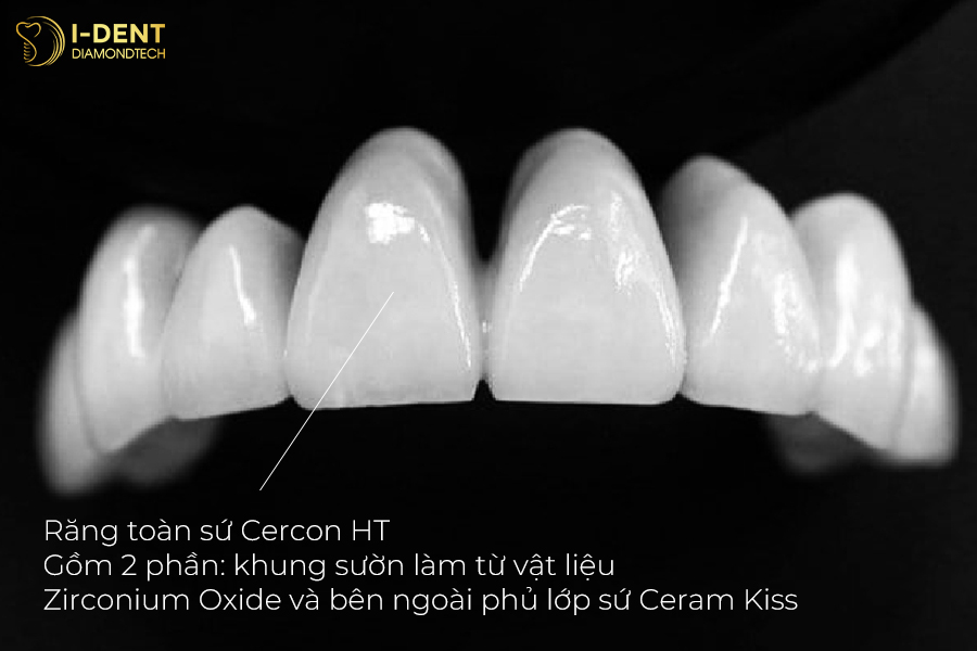 Răng sứ Cercon và 5 lợi ích vượt trội bạn cần biết