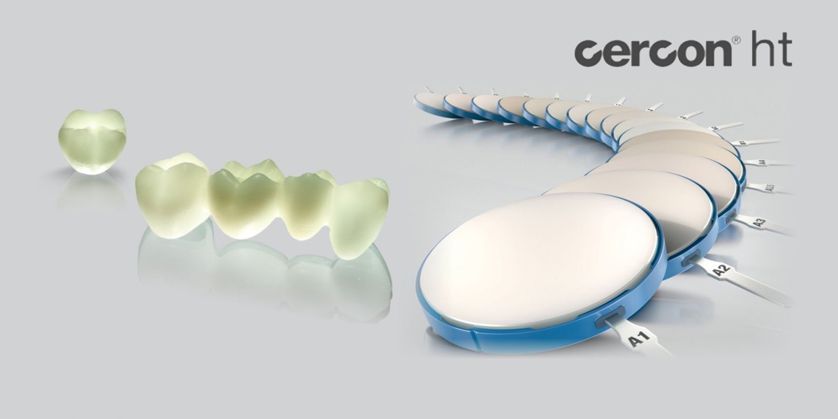 Răng sứ Cercon và 5 lợi ích vượt trội bạn cần biết