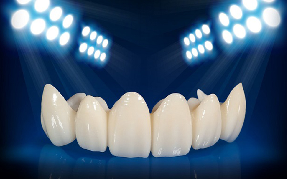 Răng sứ DDBIO: 5 ưu điểm vượt trội và quy trình thực hiện