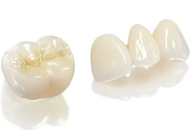 Răng sứ DDBIO: 5 ưu điểm vượt trội và quy trình thực hiện