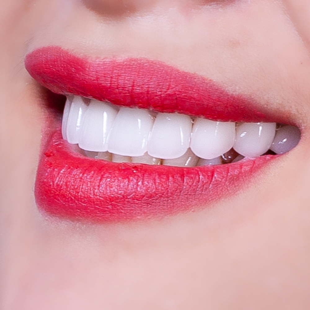 Răng sứ DDBIO: 5 ưu điểm vượt trội và quy trình thực hiện
