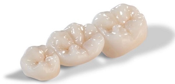 Răng sứ Lava: 6 ưu điểm vượt trội và quy trình thực hiện mới nhất