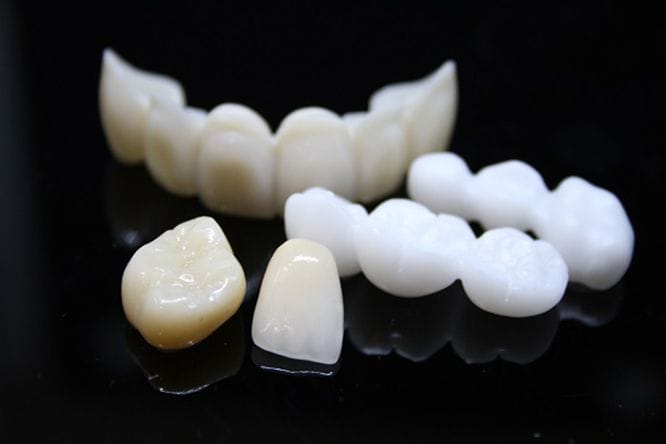 Tìm hiểu về răng sứ Nacera và 5 ưu điểm nổi bật