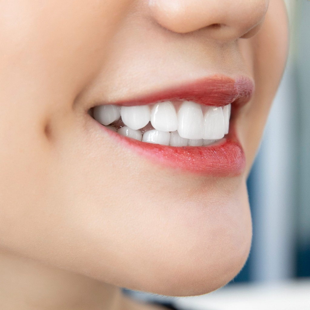 Tìm hiểu về răng sứ Nacera và 5 ưu điểm nổi bật