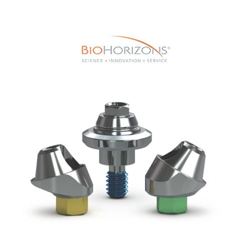 Trụ implant nào tốt nhất? 6 thương hiệu hàng đầu bạn nên biết