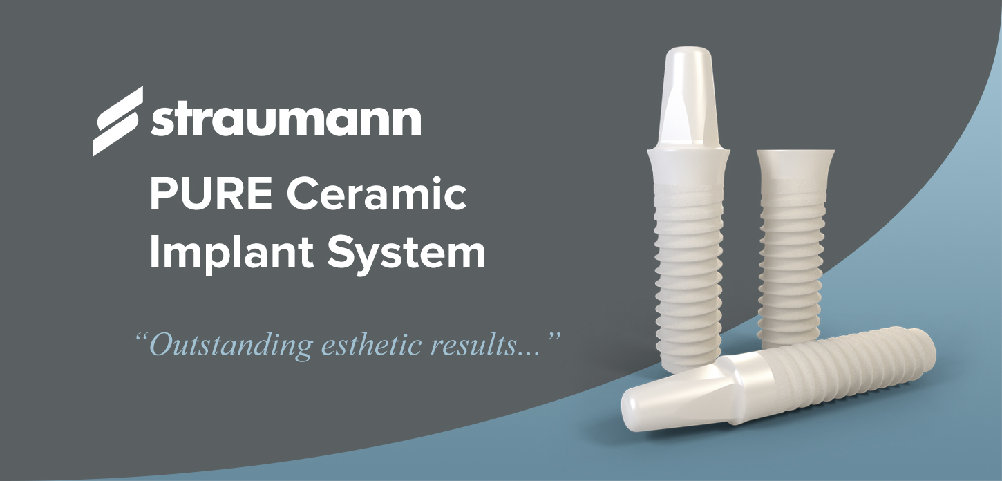 Trụ implant nào tốt nhất? 6 thương hiệu hàng đầu bạn nên biết