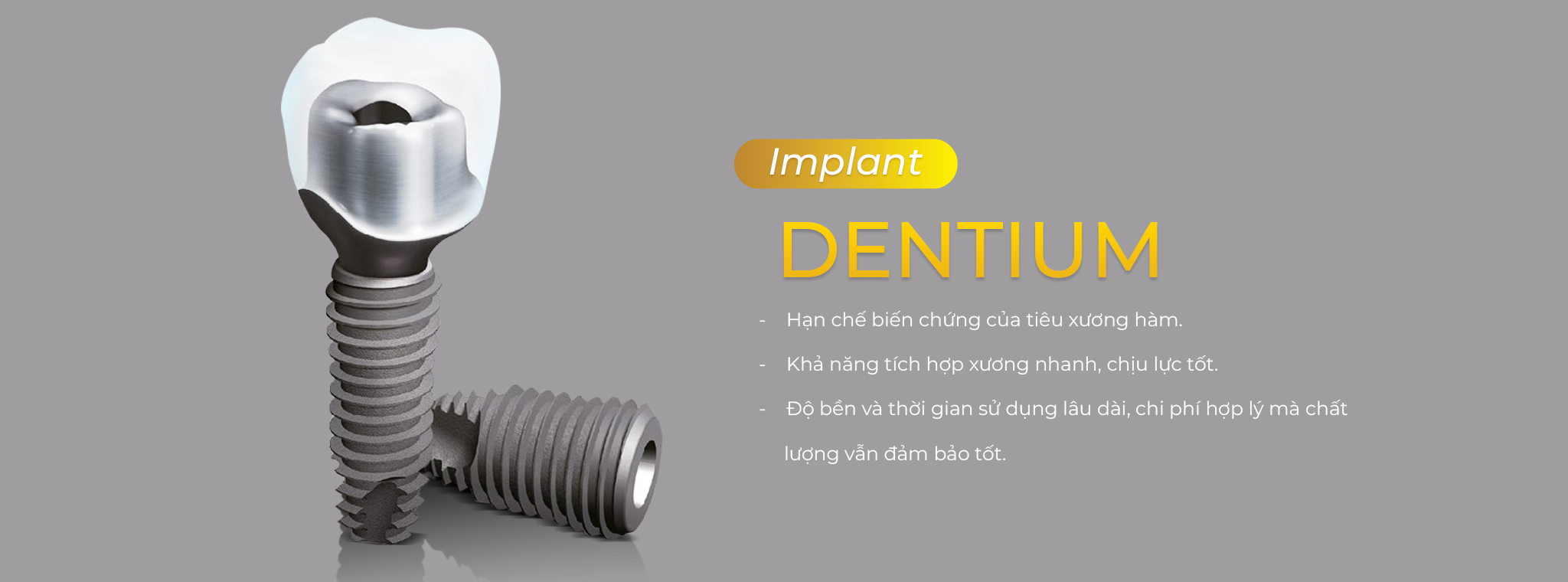 Trụ implant nào tốt nhất? 6 thương hiệu hàng đầu bạn nên biết