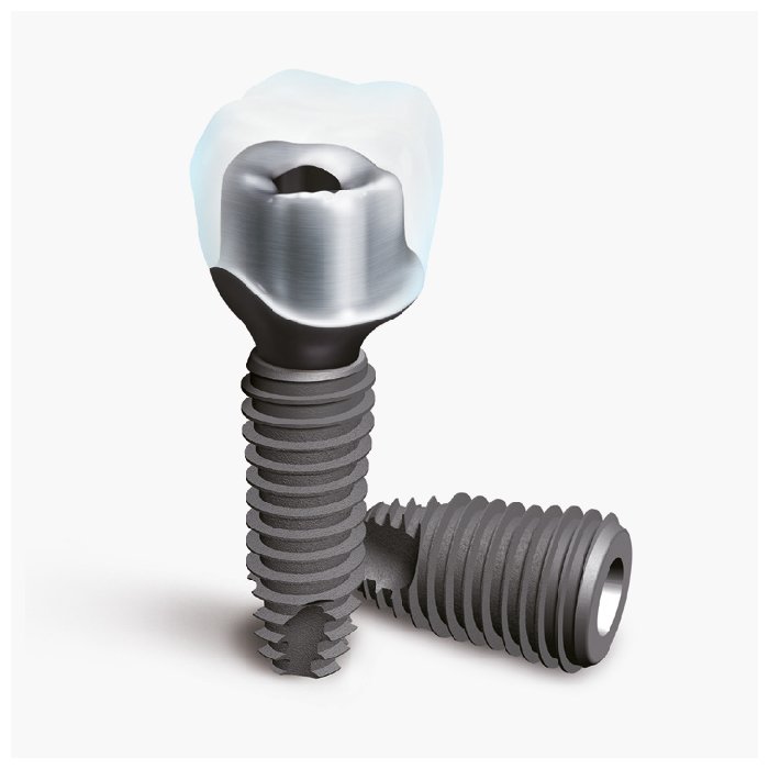 Trụ implant SIC và 5 lý do nên chọn cho phục hình răng