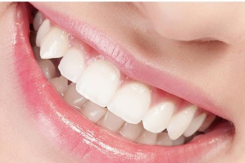 Trám răng cho người trưởng thành - Quy trình và giá thành mới nhất 2024