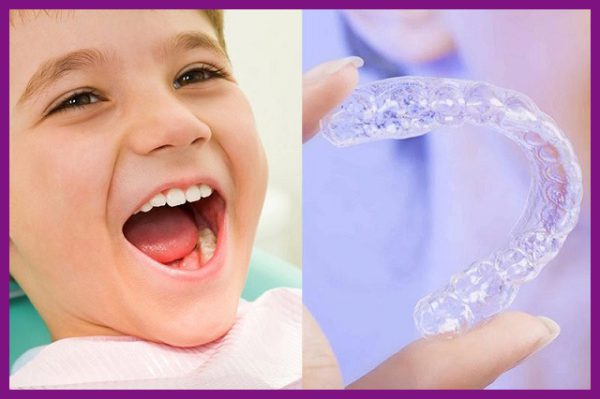 Hàm Trainer là gì? 5 điều cần biết trước khi sử dụng