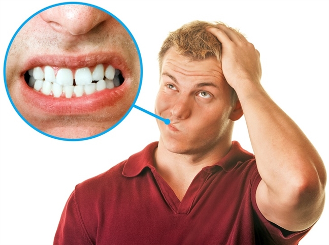 Mòn răng: Nguyên nhân, hậu quả và giải pháp phòng ngừa