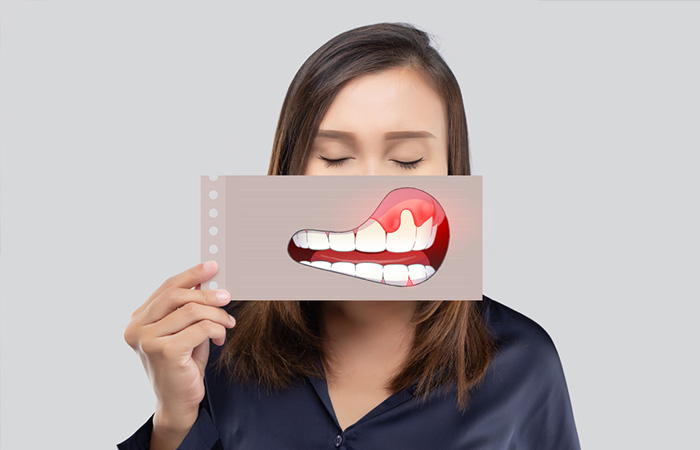 Đau nướu: Nguyên nhân và cách khắc phục hiệu quả