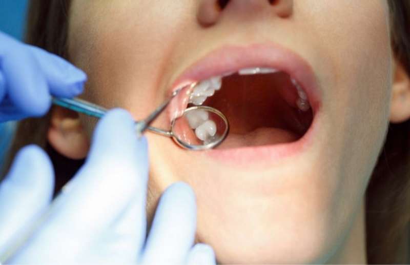 Chỉ tự tiêu hay chỉ thường: Nên chọn loại nào trong nha khoa?