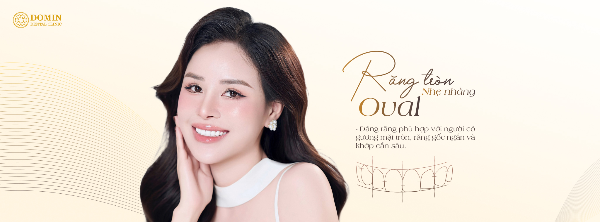 Dáng răng oval là gì? Lựa chọn hoàn hảo cho vẻ đẹp dịu dàng