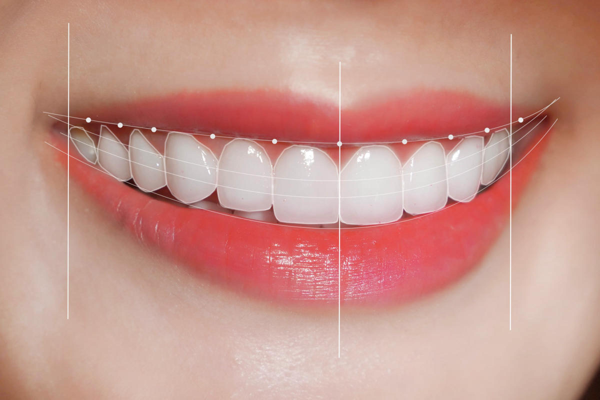 Dáng răng tròn là gì? Bí quyết sở hữu nụ cười mềm mại và trẻ trung