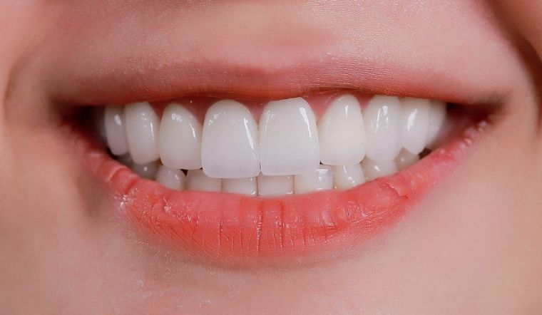 Dáng răng tròn là gì? Bí quyết sở hữu nụ cười mềm mại và trẻ trung