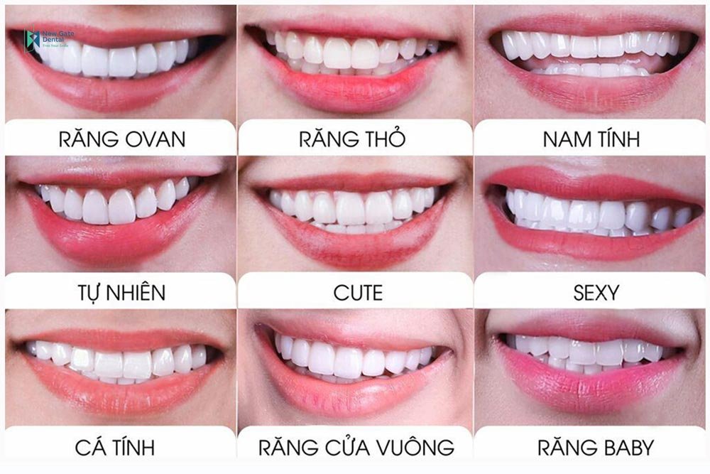 Dáng răng tròn là gì? Bí quyết sở hữu nụ cười mềm mại và trẻ trung