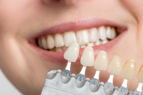 Dáng răng tròn là gì? Bí quyết sở hữu nụ cười mềm mại và trẻ trung