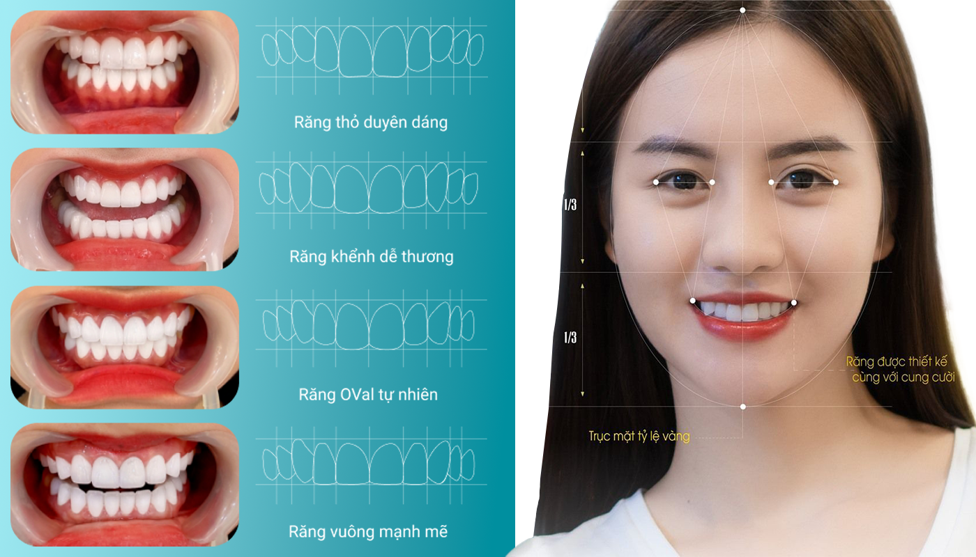 Dáng răng vuông là gì? Có phù hợp với phong cách thẩm mỹ của bạn?