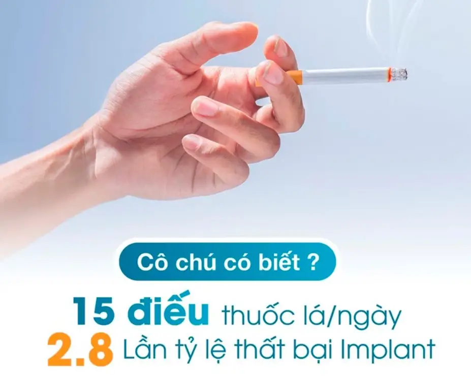 Implant bị đào thải: Nguyên nhân và cách khắc phục hiệu quả