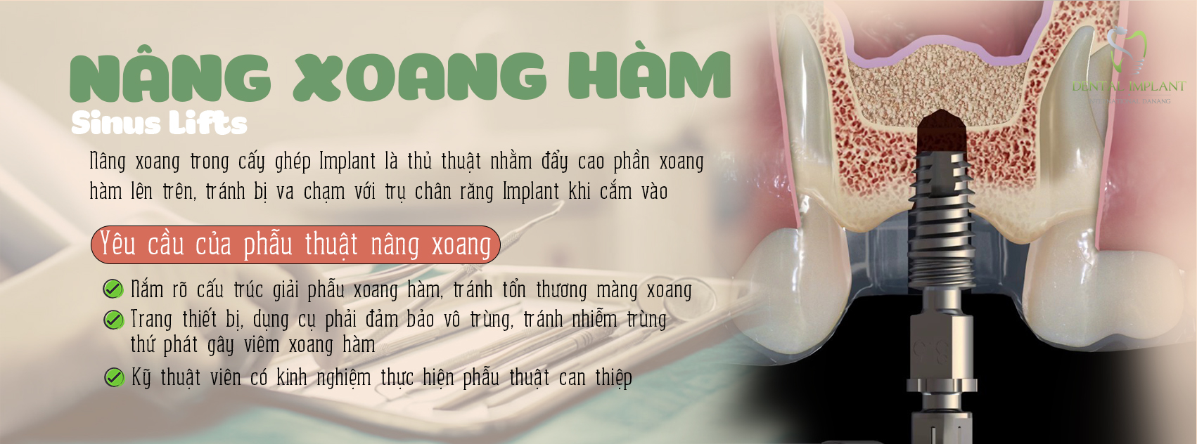 Nâng xoang ghép xương và 6 điều bạn cần biết trước khi thực hiện