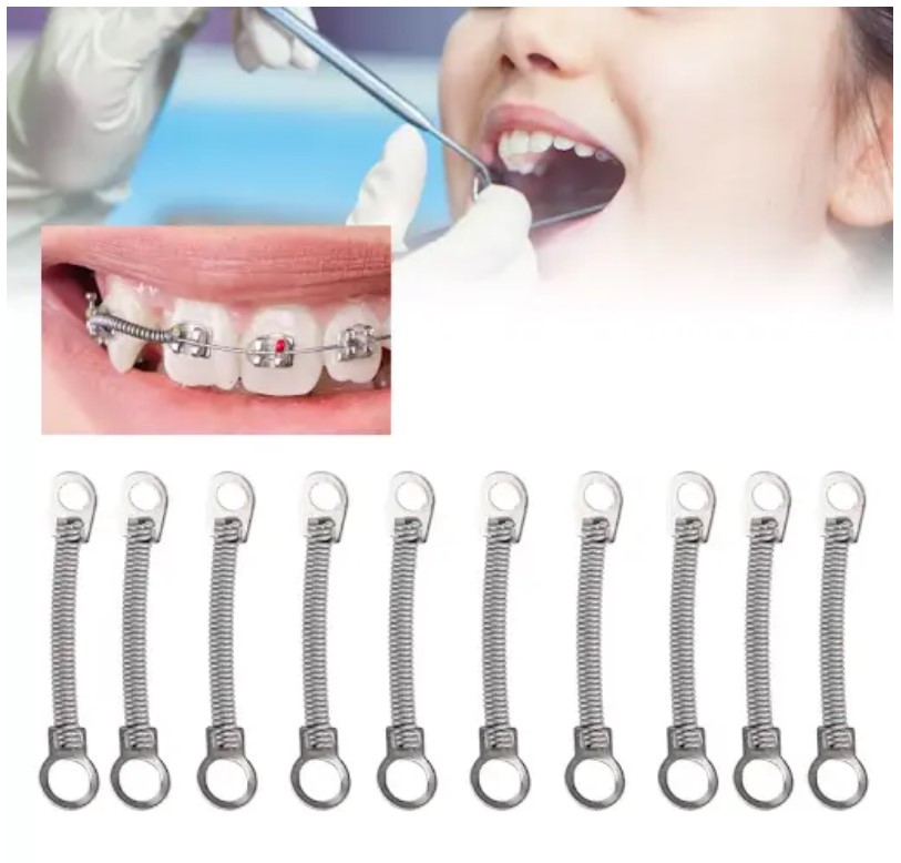 Nhổ răng khi niềng răng: 5 điều bạn cần biết trước khi thực hiện