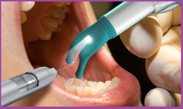 Đau Răng Số 7: Nguyên Nhân, Cách Giảm Đau Điều Trị Hiệu Quả