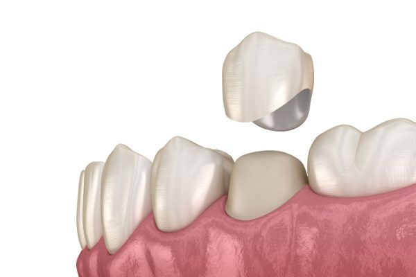 Răng số 7 bị ê buốt: Nguyên nhân và cách khắc phục hiệu quả