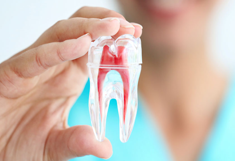 Răng số 7 bị ê buốt: Nguyên nhân và cách khắc phục hiệu quả