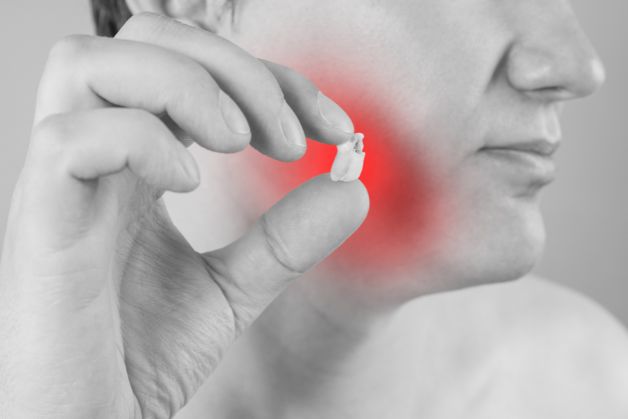 Răng số 7 gãy vỡ: Nguyên nhân, điều trị và chi phí