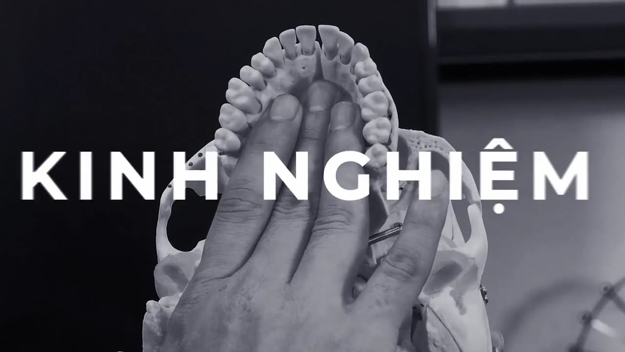 Răng số 7 là răng nào? Vị trí, chức năng cách chăm sóc