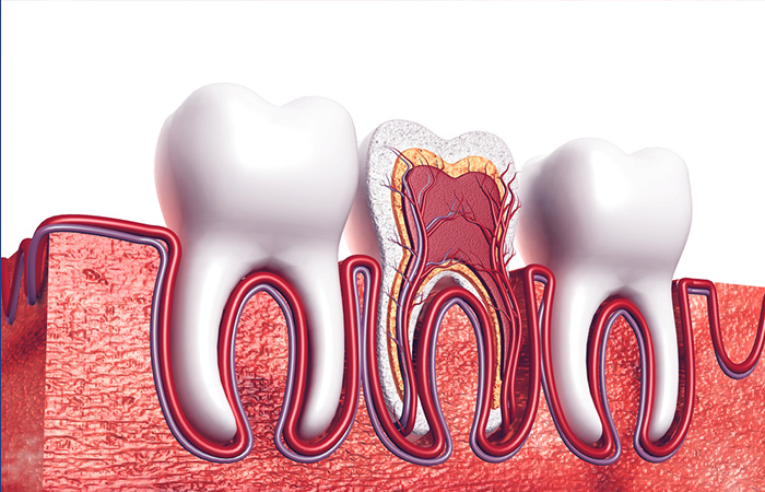 Viêm Tủy Răng Số 7: Nguyên Nhân, Triệu Chứng Điều Trị Hiệu Quả