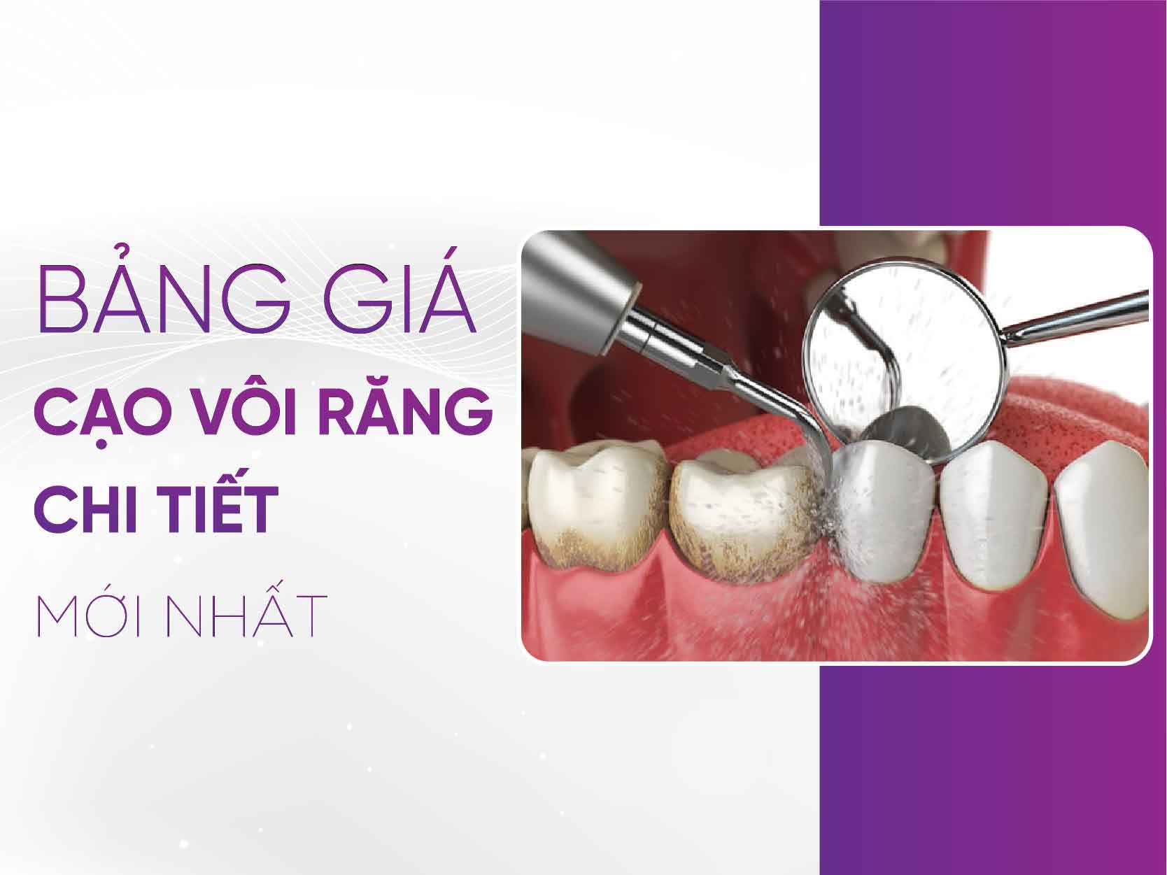 Bảng Giá Cạo Vôi Răng 2025