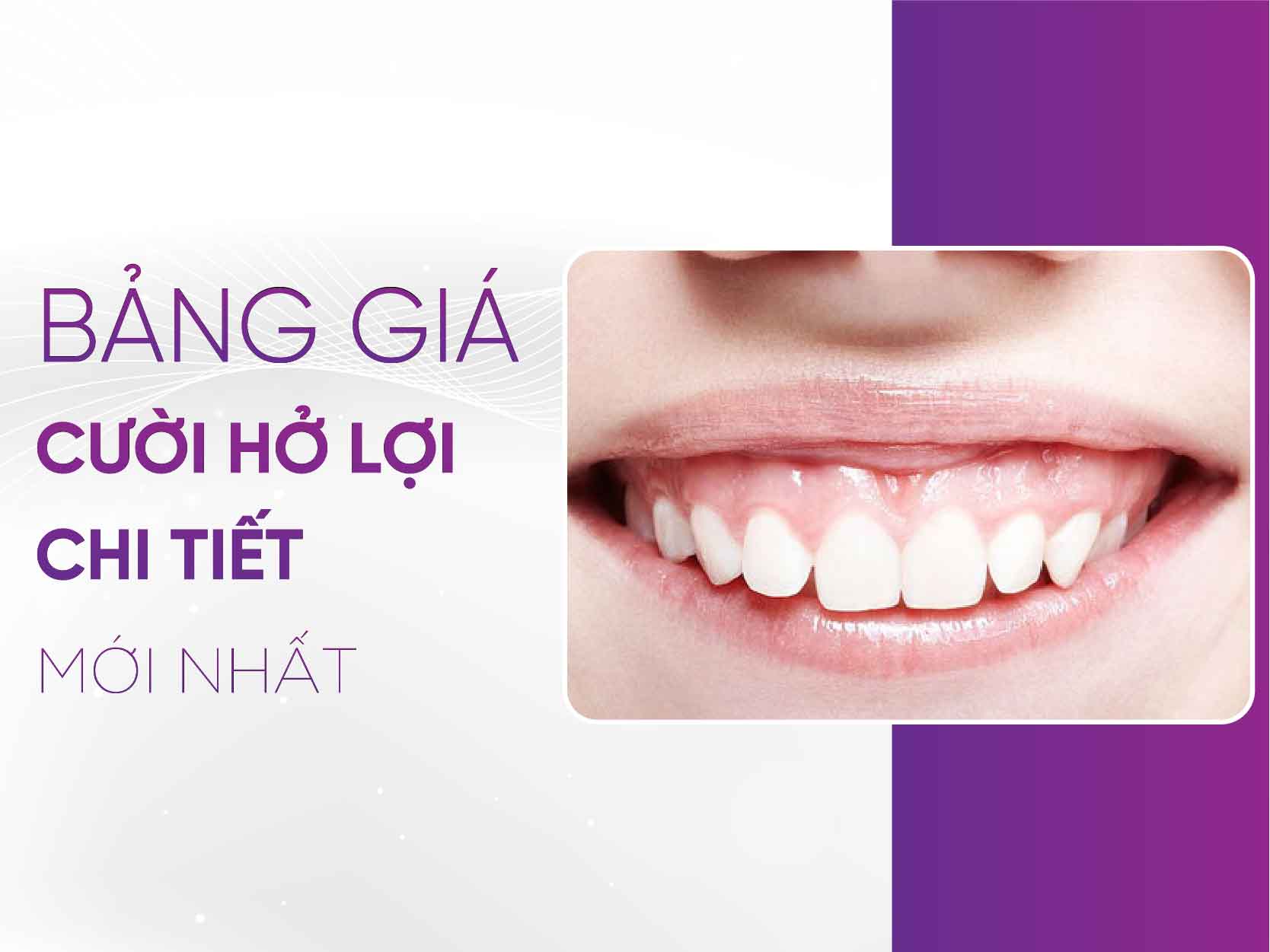 Bảng Giá Chữa Cười Hở Lợi 2025