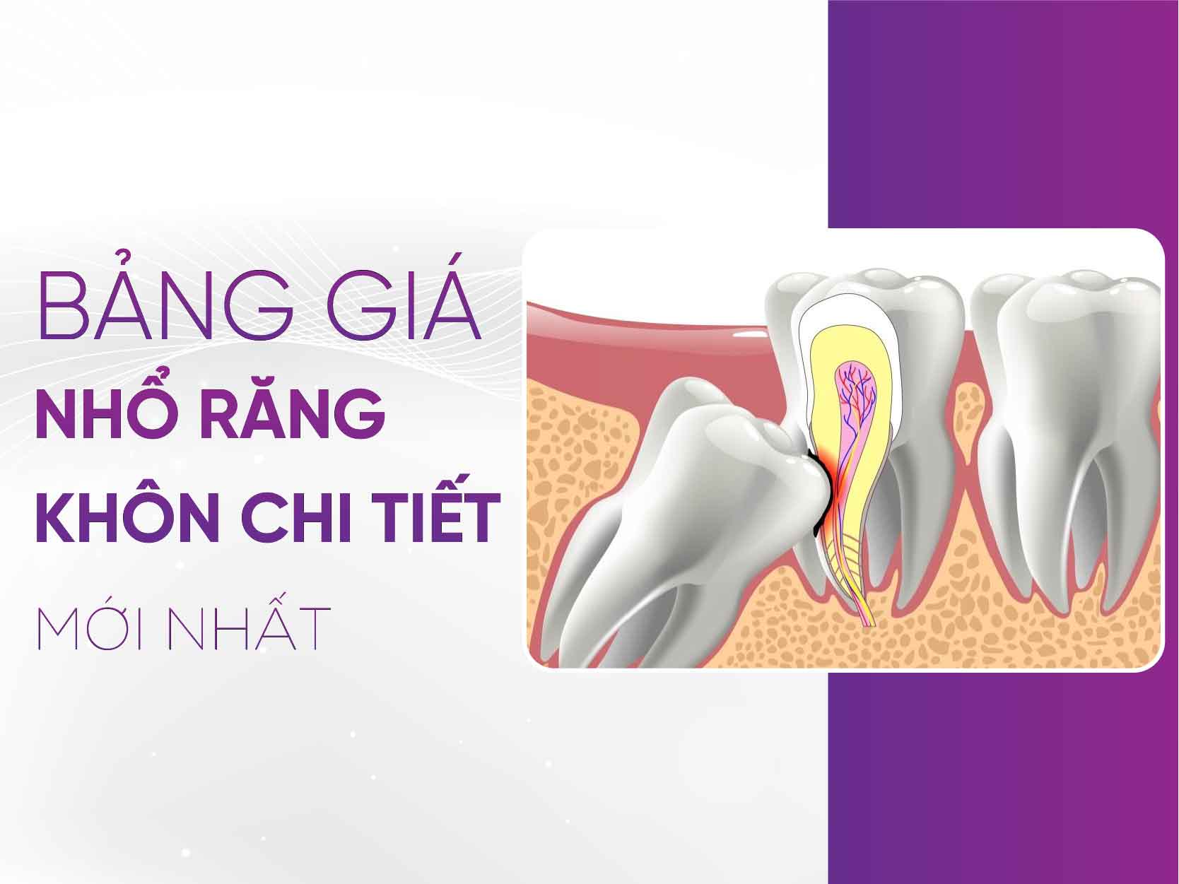 Bảng Giá Nhổ Răng Khôn Chi Tiết 2025
