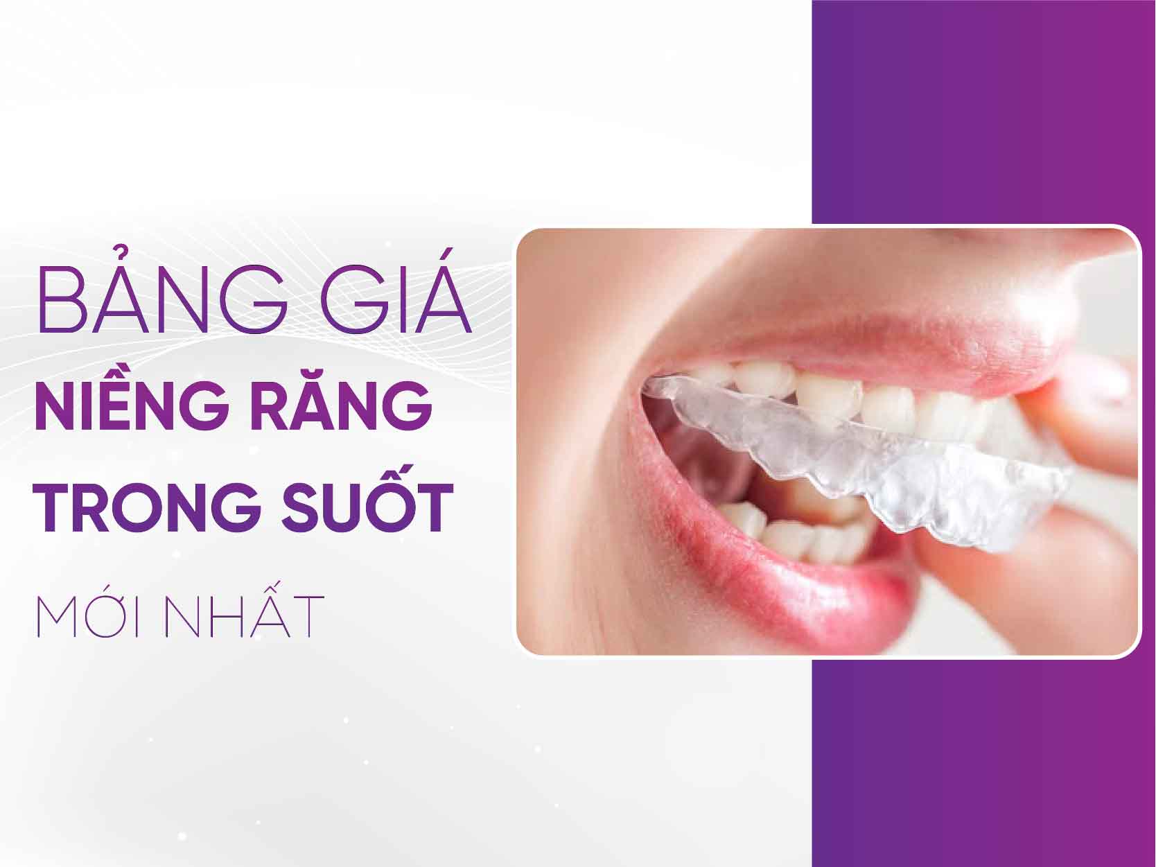 Bảng Giá Niềng Răng Trong Suốt 2025