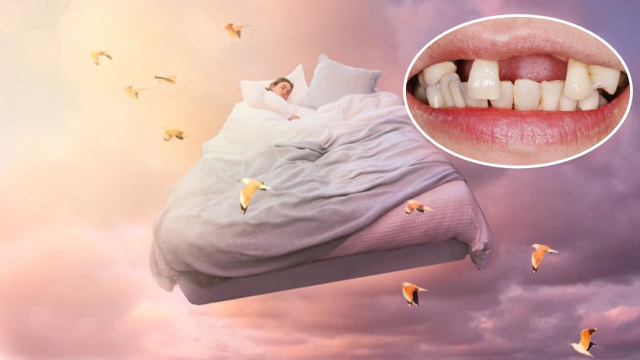 Giải Mã Giấc Mơ - Mơ Thấy Rụng Răng Và Những Điều Thú Vị