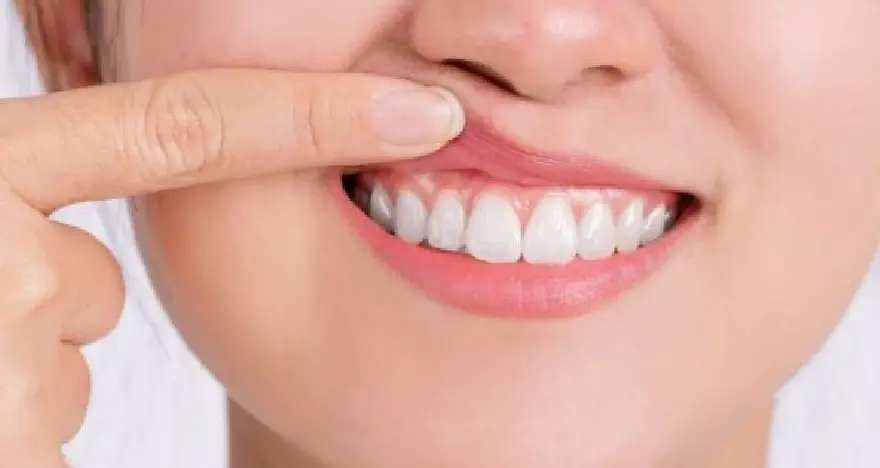 Môi trên bị giật là điềm gì? May mắn hay Xui xẻo?