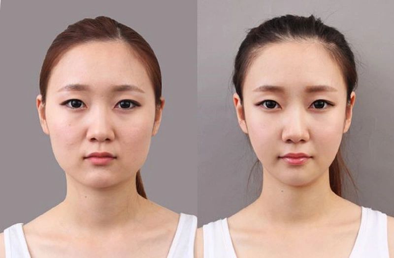 Mặt chữ điền - Đặc điểm, Vận số và Cách Tinh chỉnh Đường nét Nét đẹp