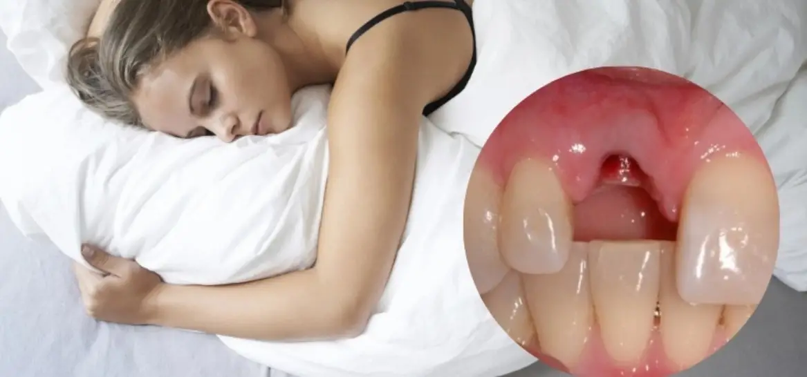 Mơ Gãy Răng - Giải Mã Những Ý Nghĩa Bí Ẩn Và Điềm Báo Tương Lai