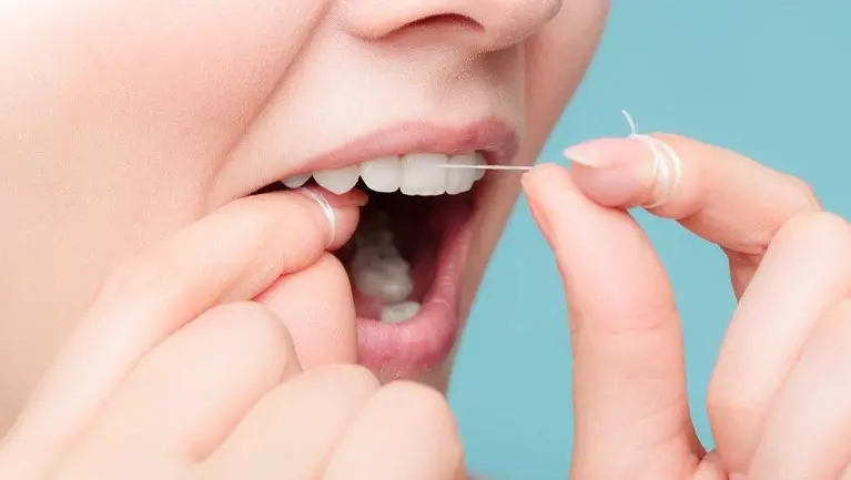 5 Bí Quyết Niềng Răng Nhanh - Sở Hữu Nụ Cười Rạng Rỡ