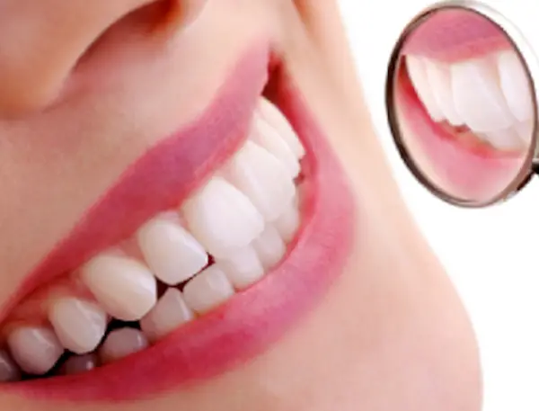 Bọc Sứ 2 Răng Cửa Bị Hô - Nụ Cười Tự Tin Trong Tầm Tay