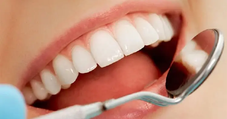 Bọc Sứ 2 Răng Cửa Bị Hô - Nụ Cười Tự Tin Trong Tầm Tay