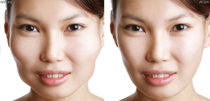 Gò Má Cao - Đặc Điểm Thẩm Mỹ Và Ý Nghĩa Sâu Sắc Đằng Sau