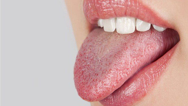 Hôi Miệng Có Lây Không? - Sự Thật, Phòng Ngừa Hiệu Quả