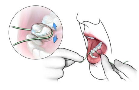 Hôi Miệng Có Lây Không? - Sự Thật, Phòng Ngừa Hiệu Quả