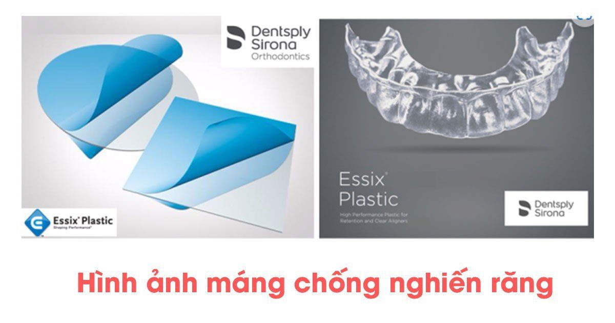 Máng Chống Nghiến - Giải Pháp Cho Giấc Ngủ Ngon Và Nụ Cười Khỏe