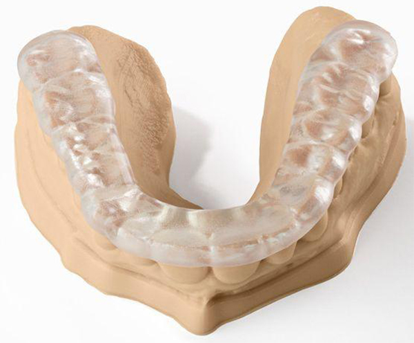Máng Chống Nghiến - Giải Pháp Cho Giấc Ngủ Ngon Và Nụ Cười Khỏe