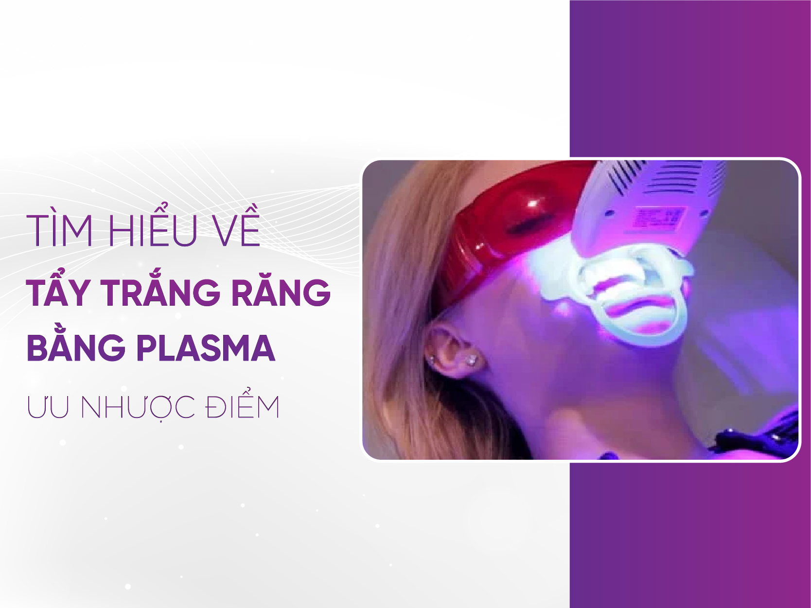 Tẩy Trắng Răng Plasma - Những Lưu Ý Bạn Cần Biết 2025