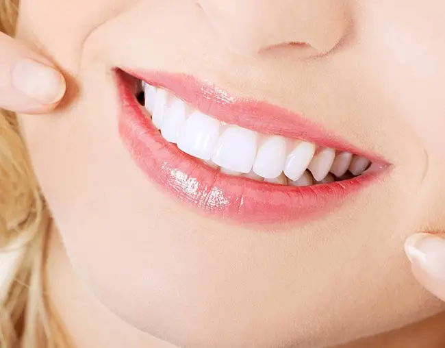Tẩy Trắng Răng Plasma - Bí Quyết Cho Nụ Cười Rạng Rỡ